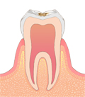 C1
