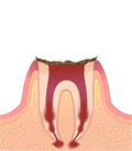 C1